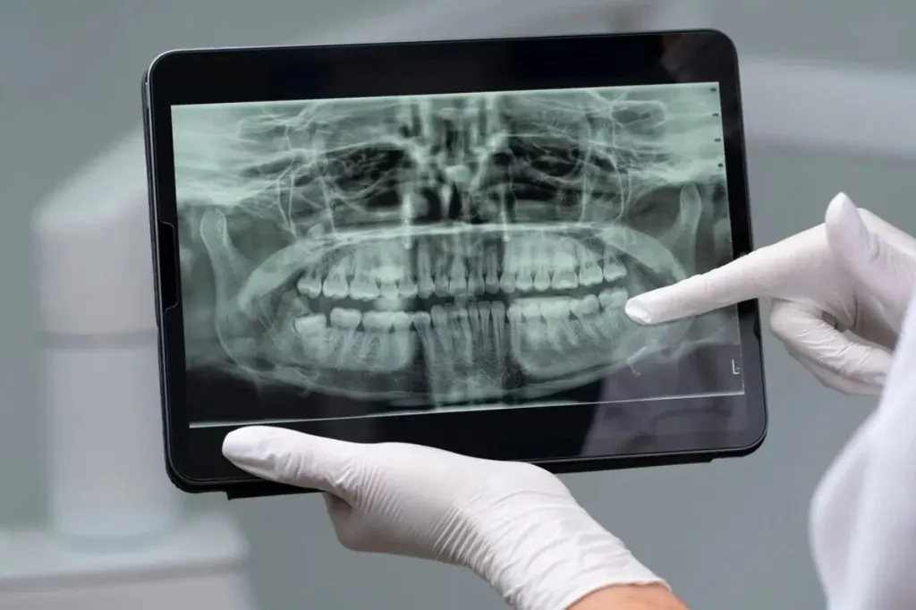 Team bespricht digitalen Implantatplan am Bildschirm